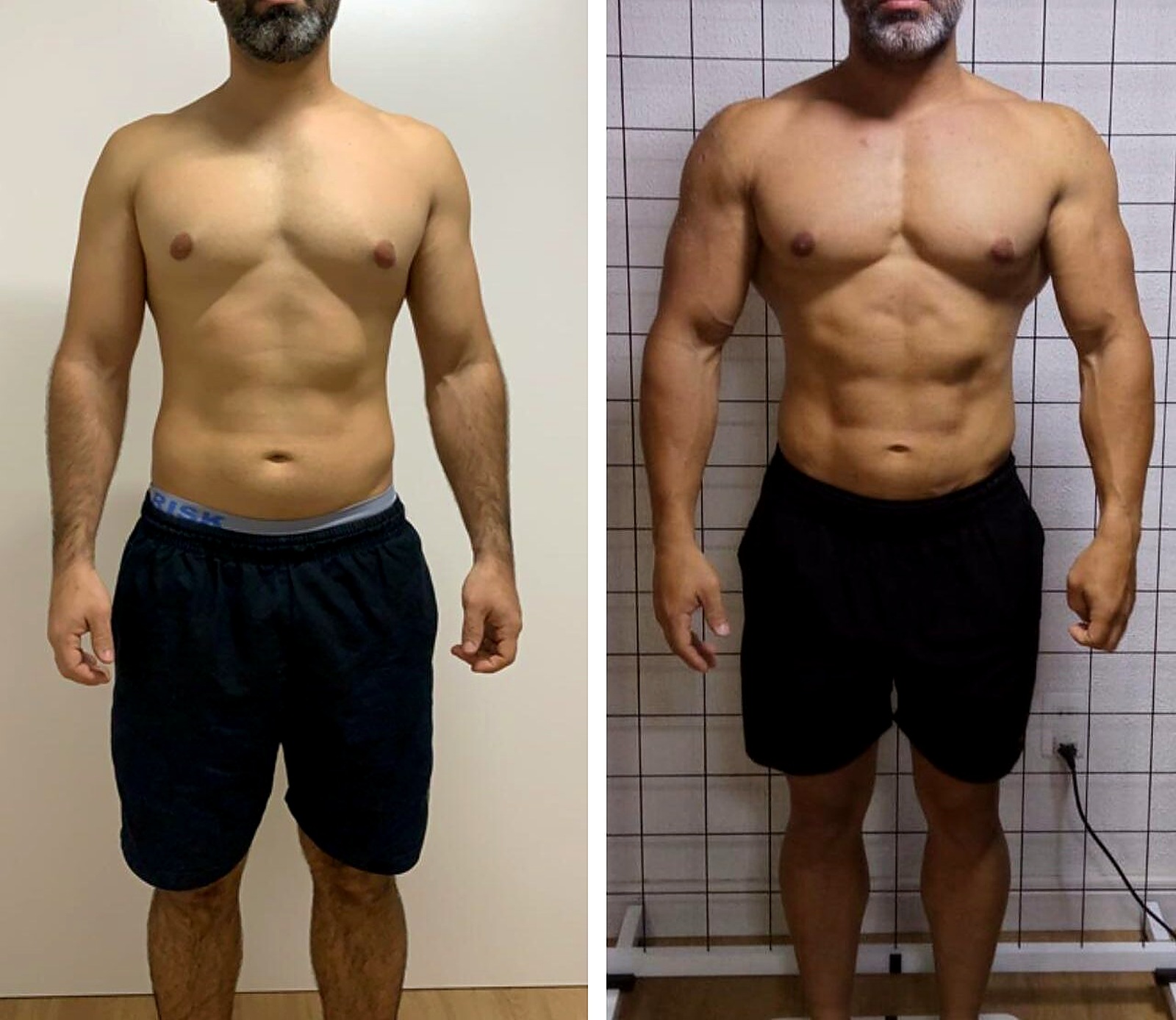 Resultado antes e depois 1 acompanhado pela ACR Clínica